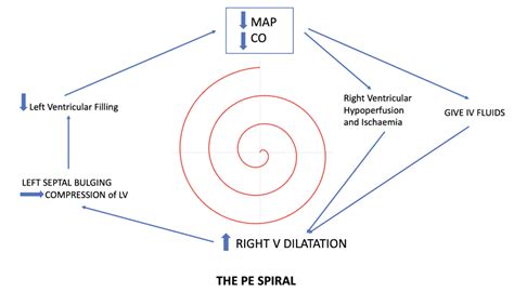 rv spiral of death